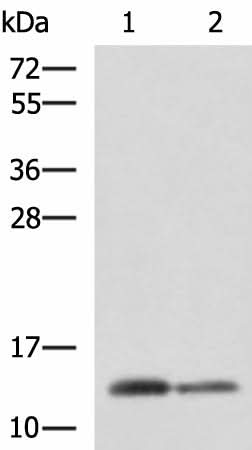 Western blot analysis of Human breast tissue and Human thyroid tissue lysates using CRABP1 Polyclonal Antibody at dilution of 1:2000
