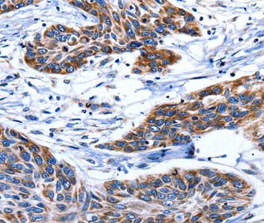 Anti-Human AQP8 Antibody