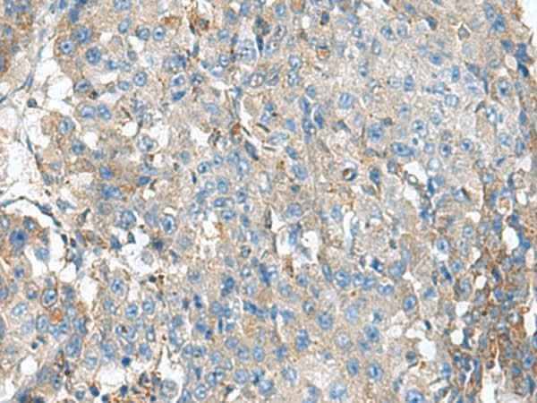 Anti-Human/Mouse KIAA0556 Antibody