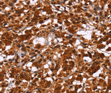 Anti-Human/Mouse/Rat HIPK1 Antibody - ABMIUM