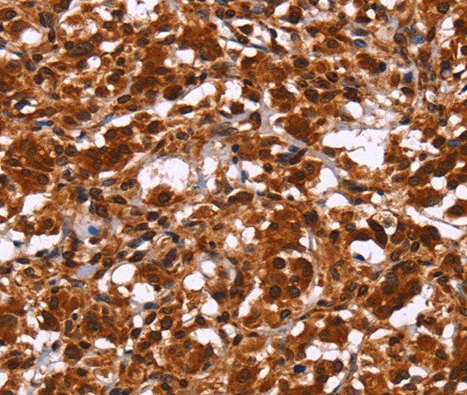 Anti-Human/Mouse/Rat HIPK1 Antibody - ABMIUM