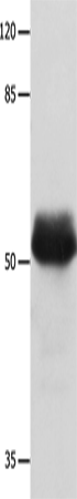 Anti-Human MUTYH Antibody - ABMIUM