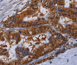 Anti-Human/Mouse/Rat MFAP3L Antibody - ABMIUM