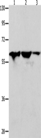 Anti-Human/Mouse DNAJC7 Antibody - ABMIUM