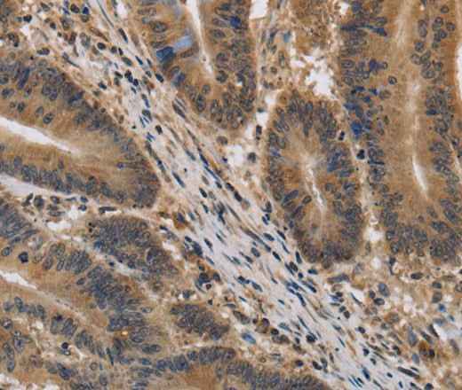 Anti-Human KIF22 Antibody