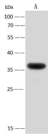 Anti-Human AIMP1 Antibody [A1034] - ABMIUM