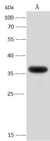 Anti-Human AIMP1 Antibody [A1034] - ABMIUM