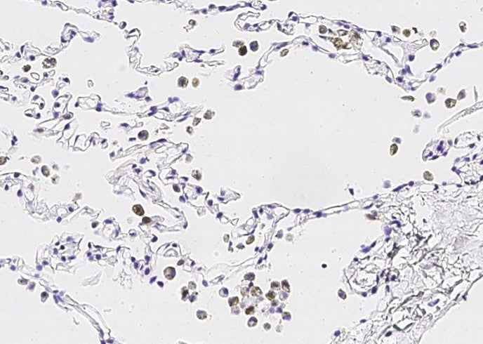 Anti-Human IL36G Antibody [B224] - ABMIUM