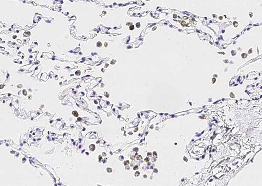 Anti-Human IL36G Antibody [B224] - ABMIUM