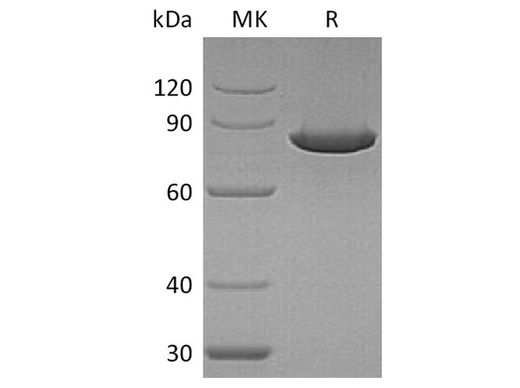 Recombinant Human Ezrin/EZR Protein - ABMIUM