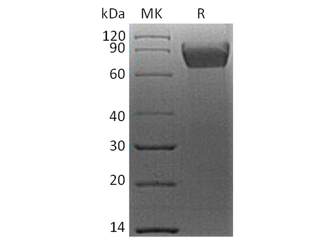 Recombinant Human B7-H4/VTCN1 Protein (mFc Tag) - ABMIUM