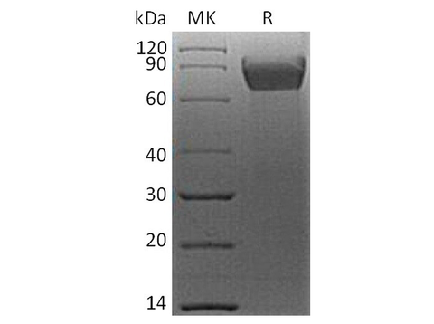 Recombinant Human B7-H4/VTCN1 Protein (mFc Tag) - ABMIUM