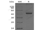 Recombinant Human FIBP Protein - ABMIUM