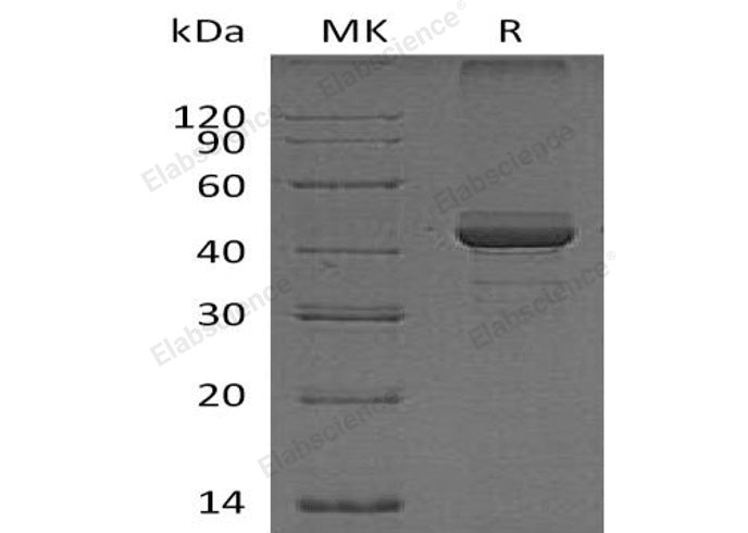 Recombinant Human FIBP Protein - ABMIUM