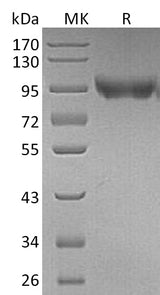Recombinant Mouse CD31/PECAM1 Protein (His Tag) - ABMIUM