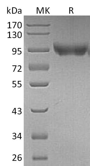 Recombinant Mouse CD31/PECAM1 Protein (His Tag) - ABMIUM