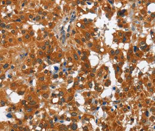 Anti-Human/Mouse/Rat PAK2 Antibody