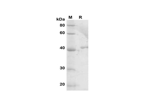 SDS-PAGE analysis of Human JNK1/MAPK8 proteins, 2 μg/lane of Recombinant Human JNK1/MAPK8 proteins was resolved with SDS-PAGE under reducing conditions, showing bands at 42 kDa.