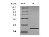 Recombinant Human ZG16 Protein (His Tag) - ABMIUM