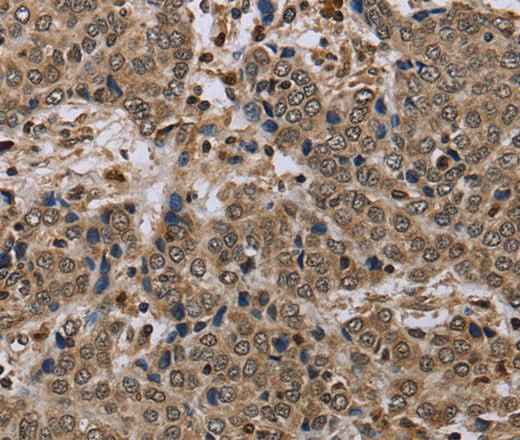 Anti-Human NLRP4 Antibody