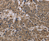 Anti-Human NLRP4 Antibody - ABMIUM