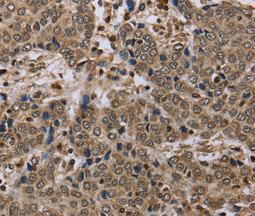 Anti-Human NLRP4 Antibody - ABMIUM