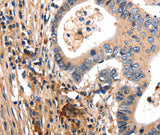 Anti-Human GSK3A Antibody - ABMIUM