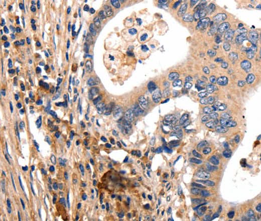 Anti-Human GSK3A Antibody - ABMIUM
