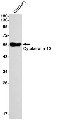 Western blot detection of Cytokeratin 10 in CHO-K1 cell lysates using Cytokeratin 10 Rabbit mAb(1:1000 diluted).Predicted band size:59kDa.Observed band size:59kDa.