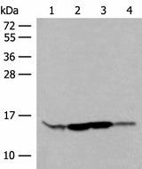 Western blot analysis of HL60 Hela 231 cell Human breast cancer tissue lysates using RPP14 Polyclonal Antibody at dilution of 1:400