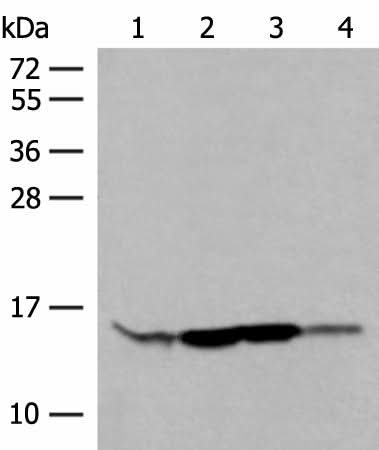 Western blot analysis of HL60 Hela 231 cell Human breast cancer tissue lysates using RPP14 Polyclonal Antibody at dilution of 1:400