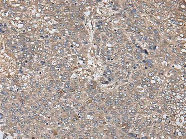 Anti-Human/Mouse/Rat ZFP36 Antibody