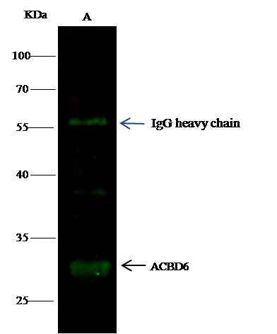 Anti-Human ACBD6 Antibody [A1058] - ABMIUM