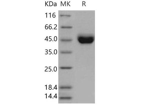 Recombinant Mouse CD5 Protein (aa 1-371, His Tag) - ABMIUM