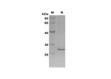 SDS-PAGE analysis of Rat NGAL/LCN2 proteins, 2 μg/lane of Recombinant Rat NGAL/LCN2 proteins was resolved with SDS-PAGE under reducing conditions, showing bands at 24 kDa.