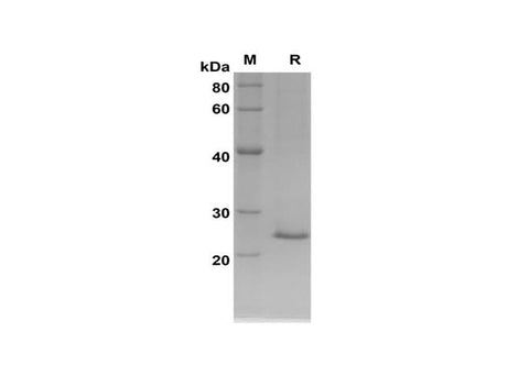 SDS-PAGE analysis of Rat NGAL/LCN2 proteins, 2 μg/lane of Recombinant Rat NGAL/LCN2 proteins was resolved with SDS-PAGE under reducing conditions, showing bands at 24 kDa.