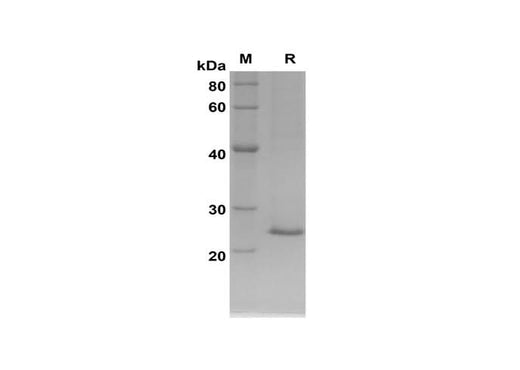 SDS-PAGE analysis of Rat NGAL/LCN2 proteins, 2 μg/lane of Recombinant Rat NGAL/LCN2 proteins was resolved with SDS-PAGE under reducing conditions, showing bands at 24 kDa.