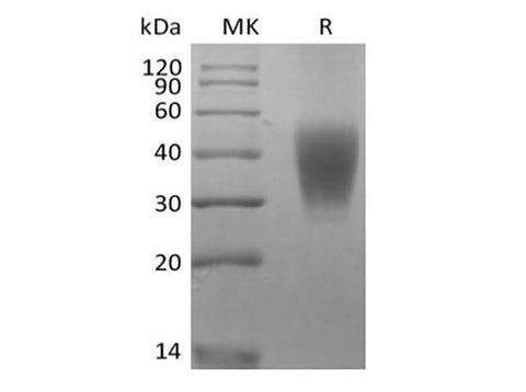 Recombinant Rhesus Macaque SLAM Family Member 7/SLAMF7/CD319/CRACC (C-6His) - ABMIUM
