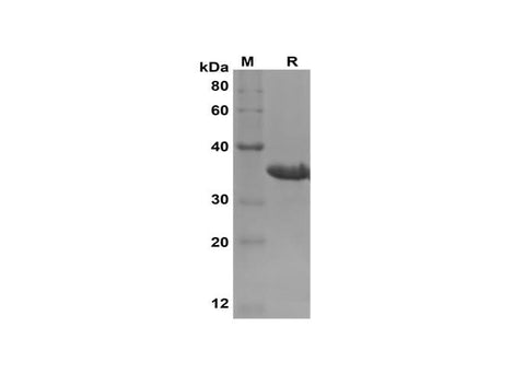 SDS-PAGE analysis of Rat IL-1β proteins, 2 μg/lane of Recombinant Rat IL-1β proteins was resolved with SDS-PAGE under reducing conditions, showing bands at 36 kDa.