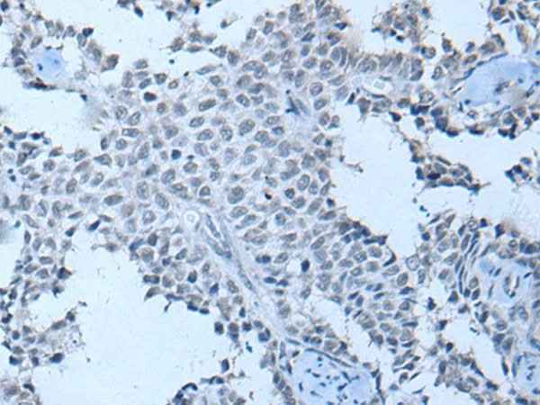 Anti-Human/Mouse ZNF703 Antibody