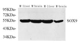 Western Blot analysis of various samples using SOX-9 Polyclonal Antibody at dilution of 1:750.