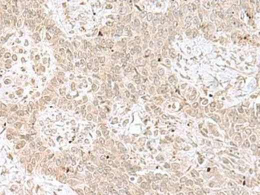 Anti-Human/Mouse/Rat RPL35 Antibody