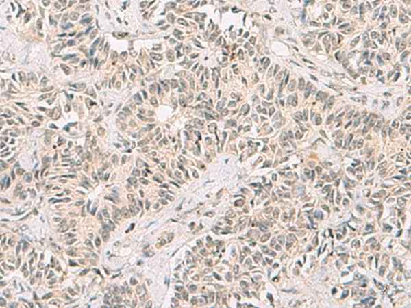 Anti-Human/Mouse/Rat RNF13 Antibody