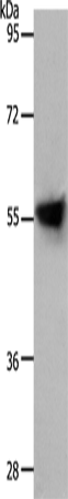 Anti-Human/Mouse SLC1A4 Antibody - ABMIUM