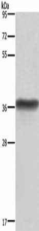 Anti-Human HSD17B1 Antibody