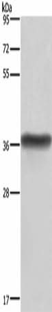 Anti-Human HSD17B1 Antibody - ABMIUM