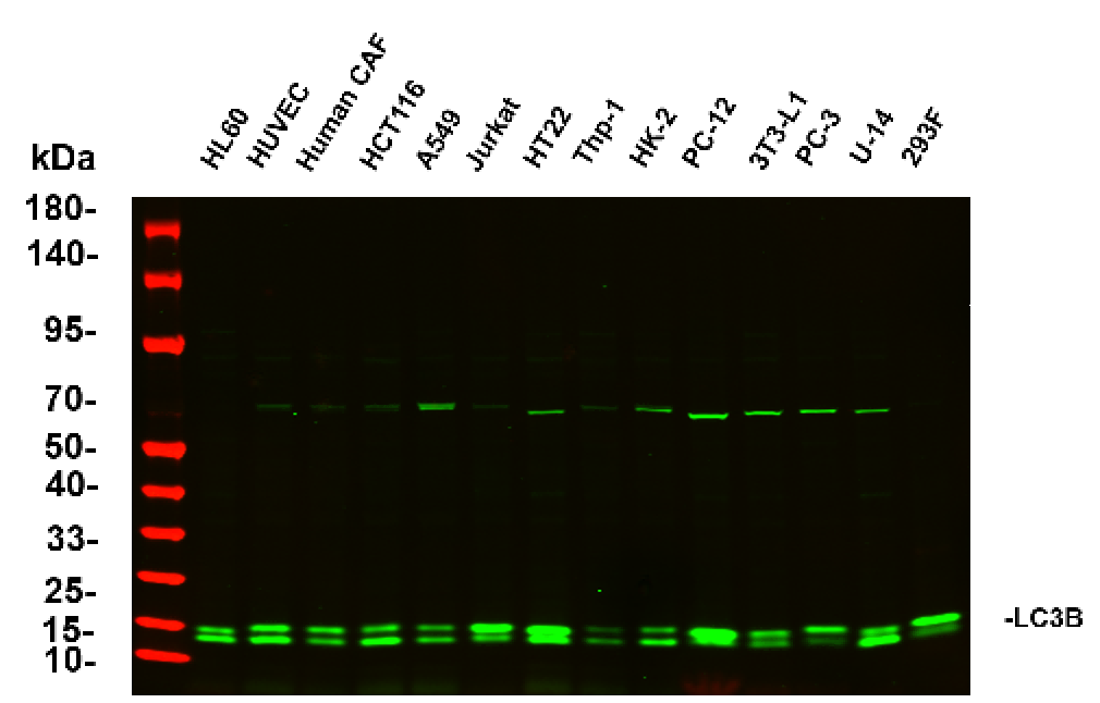 Anti-Human/Mouse/Rat LC3B Antibody [5A10] - ABMIUM