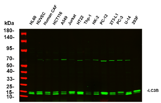 Anti-Human/Mouse/Rat LC3B Antibody [5A10] - ABMIUM
