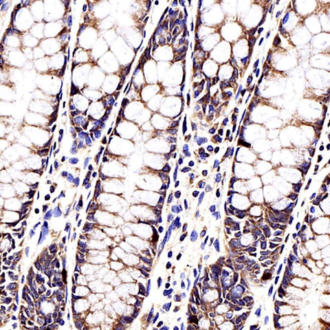 Immunohistochemistry analysis of paraffin-embedded human colon using CCL2 Polyclonal Antibody at dilution of 1:500.