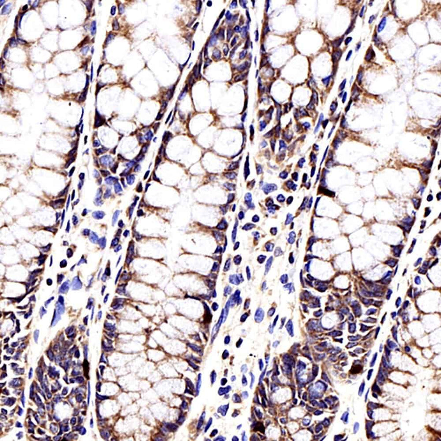 Immunohistochemistry analysis of paraffin-embedded human colon using CCL2 Polyclonal Antibody at dilution of 1:500.